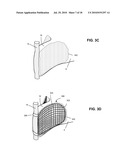 SYSTEMS AND METHODS FOR INJECTING BONE FILLER INTO THE SPINE diagram and image