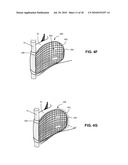 SYSTEMS AND METHODS FOR INJECTING BONE FILLER INTO THE SPINE diagram and image