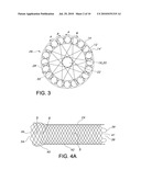 ATRAUMATIC STENT AND METHOD AND APPARATUS FOR MAKING THE SAME diagram and image