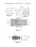 ATRAUMATIC STENT AND METHOD AND APPARATUS FOR MAKING THE SAME diagram and image