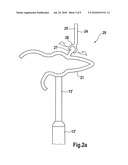 Passive ossicle prosthesis comprising applicator diagram and image