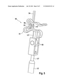 Passive ossicle prosthesis comprising applicator diagram and image