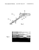 SPINAL NUCLEUS PROSTHESIS DEVICE diagram and image