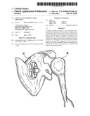 Articulating humeral Head Prosthesis diagram and image