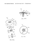 Articulating humeral Head Prosthesis diagram and image