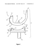 LATERAL CONDYLE POSTERIOR INFLECTION FOR TOTAL KNEE IMPLANT diagram and image