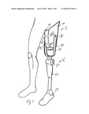 Prosthesis Socket and System Comprising a Prosthesis Socket and Prosthesis Device diagram and image