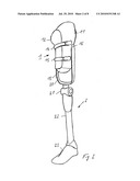 Prosthesis Socket and System Comprising a Prosthesis Socket and Prosthesis Device diagram and image