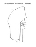 Prosthesis Socket and System Comprising a Prosthesis Socket and Prosthesis Device diagram and image