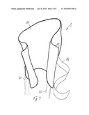 Prosthesis Socket and System Comprising a Prosthesis Socket and Prosthesis Device diagram and image