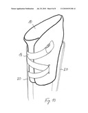 Prosthesis Socket and System Comprising a Prosthesis Socket and Prosthesis Device diagram and image