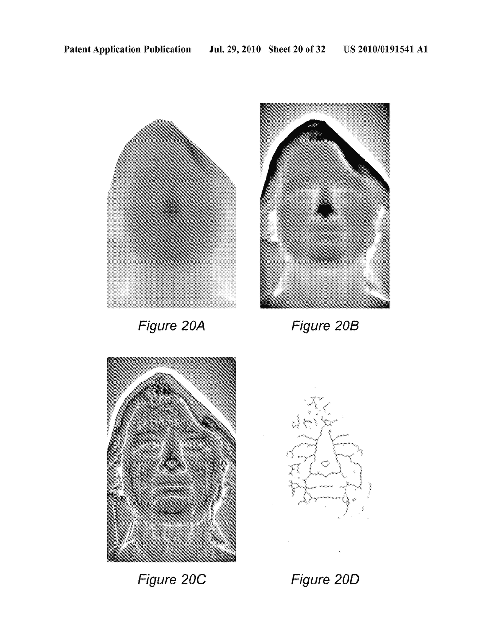 SYSTEM AND METHOD FOR USING THREE DIMENSIONAL INFRARED IMAGING FOR LIBRARIES OF STANDARDIZED MEDICAL IMAGERY - diagram, schematic, and image 21