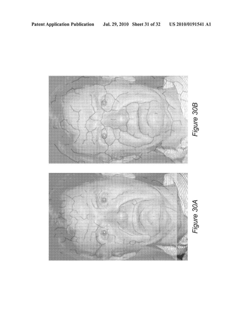 SYSTEM AND METHOD FOR USING THREE DIMENSIONAL INFRARED IMAGING FOR LIBRARIES OF STANDARDIZED MEDICAL IMAGERY - diagram, schematic, and image 32