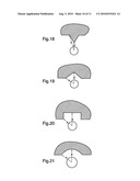 FLUID TREATMENT SYSTEM diagram and image