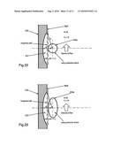 FLUID TREATMENT SYSTEM diagram and image