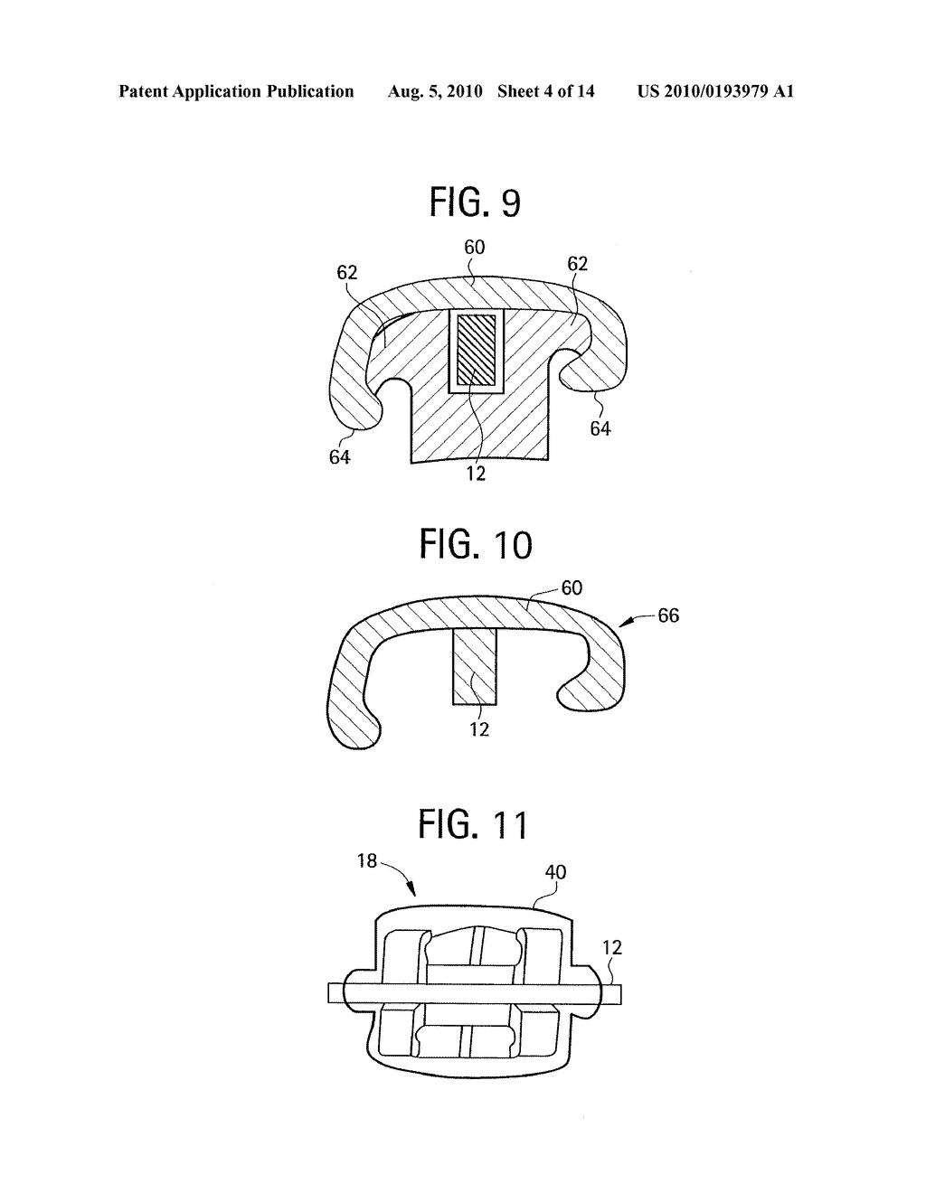 Advanced Thermoplastics for Orthodontics - diagram, schematic, and image 05