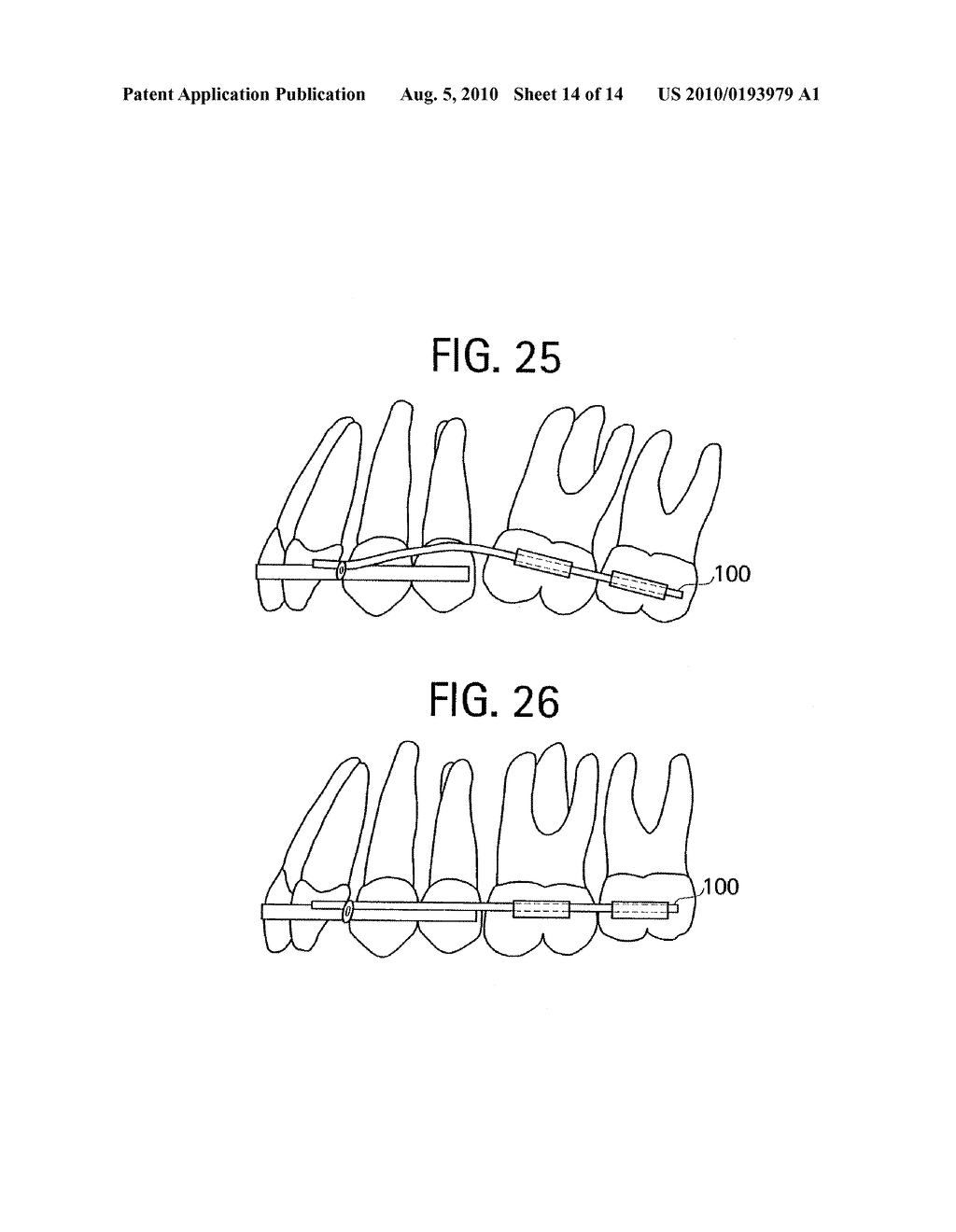 Advanced Thermoplastics for Orthodontics - diagram, schematic, and image 15