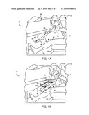 INFLATABLE RESTRAINT SYSTEM WITH DEPLOYMENT TRAJECTORY CONTROLLER diagram and image