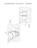 VENTILATION DUCT ASSEMBLY KIT AND METHOD OF ASSEMBLY USING THE SAME diagram and image