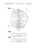 GRADIENT COIL DEVICE, MAGNETIC RESONANCE IMAGING DEVICE, AND METHOD OF DESIGNING COIL PATTERN diagram and image