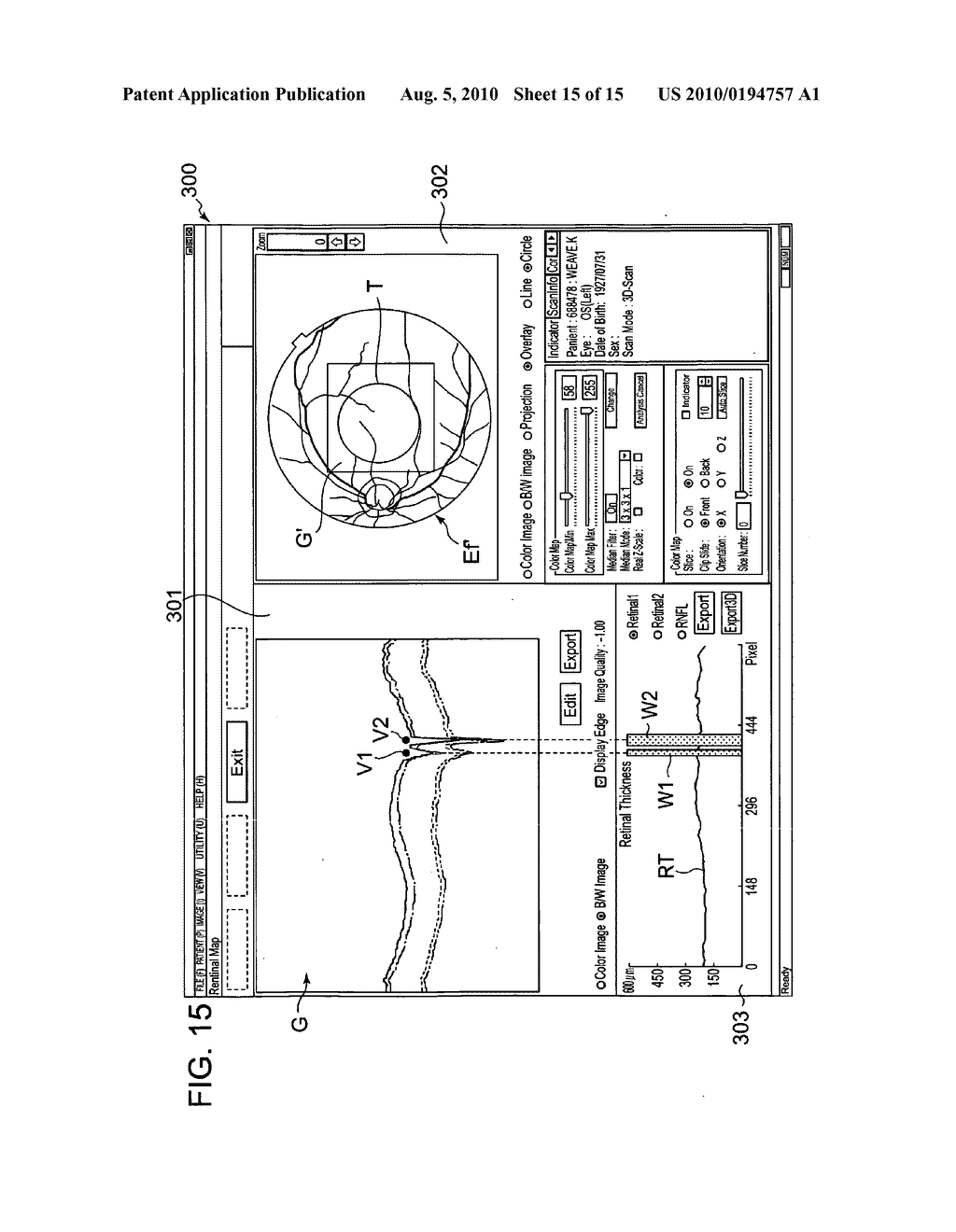 FUNDUS OCULI OBSERVATION DEVICE, OPHTHALMOLOGIC IMAGE PROCESSING DEVICE, AND PROGRAM - diagram, schematic, and image 16
