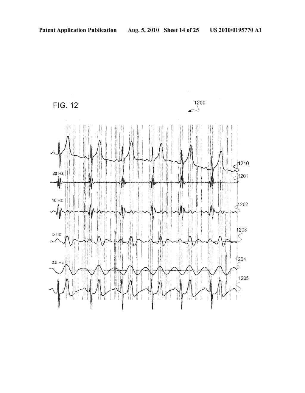 SIGNAL DECOMPOSITION, ANALYSIS AND RECONSTRUCTION APPARATUS AND METHOD - diagram, schematic, and image 15