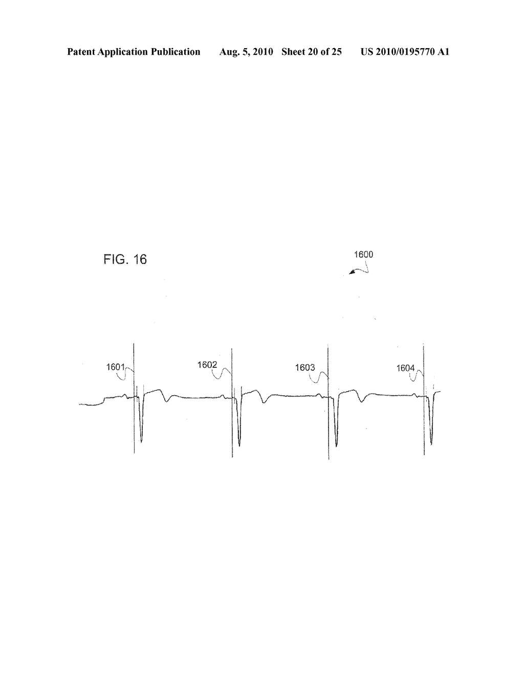 SIGNAL DECOMPOSITION, ANALYSIS AND RECONSTRUCTION APPARATUS AND METHOD - diagram, schematic, and image 21