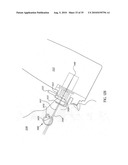 ORTHOVOLTAGE RADIOTHERAPY diagram and image