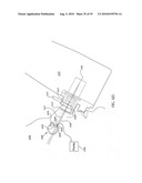 ORTHOVOLTAGE RADIOTHERAPY diagram and image