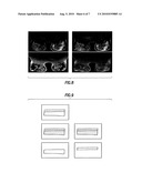 METHODS OF EFFICIENT AND IMPROVED PHASE-SENSITIVE MRI diagram and image