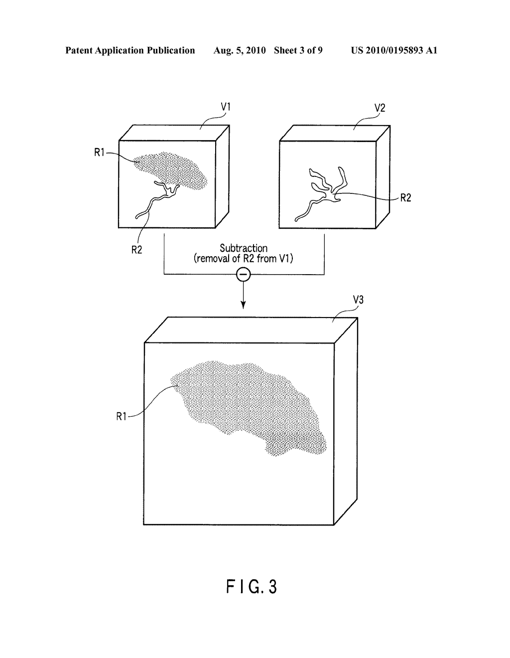 X-RAY DIAGNOSIS APPARATUS AND IMAGE PROCESSING APPARATUS - diagram, schematic, and image 04