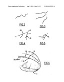 DEVICE AND METHOD FOR SUPERIMPOSING PATTERNS ON IMAGES IN REAL-TIME, PARTICULARLY FOR GEOGRAPHIC GUIDANCE diagram and image