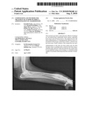 Compositions and methods for treatment of tumors by direct administration of a radioisotope diagram and image