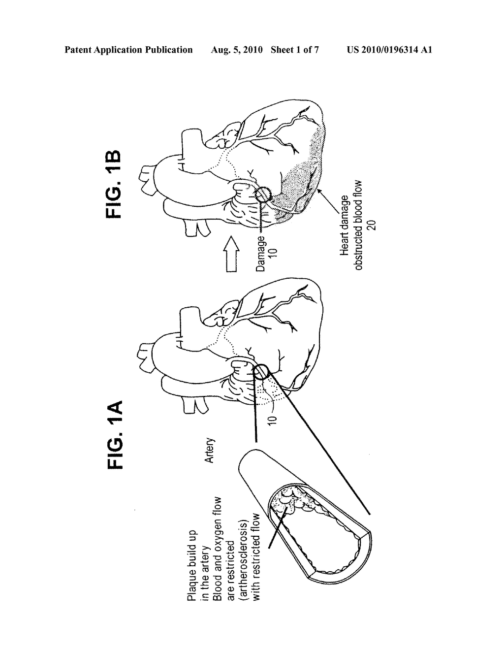 Modified Two-Component Gelation Systems, Methods of Use and Methods of Manufacture - diagram, schematic, and image 02