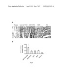 COMPOSITIONS AND METHODS FOR TREATING CARDIOVASCULAR DISEASE diagram and image