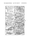 COMPOSITIONS AND METHODS FOR TREATING CARDIOVASCULAR DISEASE diagram and image