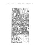 COMPOSITIONS AND METHODS FOR TREATING CARDIOVASCULAR DISEASE diagram and image