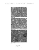 MEDICAL DEVICES HAVING A SURFACE INCLUDING A BIOLOGICALLY ACTIVE AGENT THEREIN diagram and image