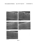 MEDICAL DEVICES HAVING A SURFACE INCLUDING A BIOLOGICALLY ACTIVE AGENT THEREIN diagram and image