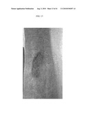 Treatment of Wounds and Compositions Employed diagram and image