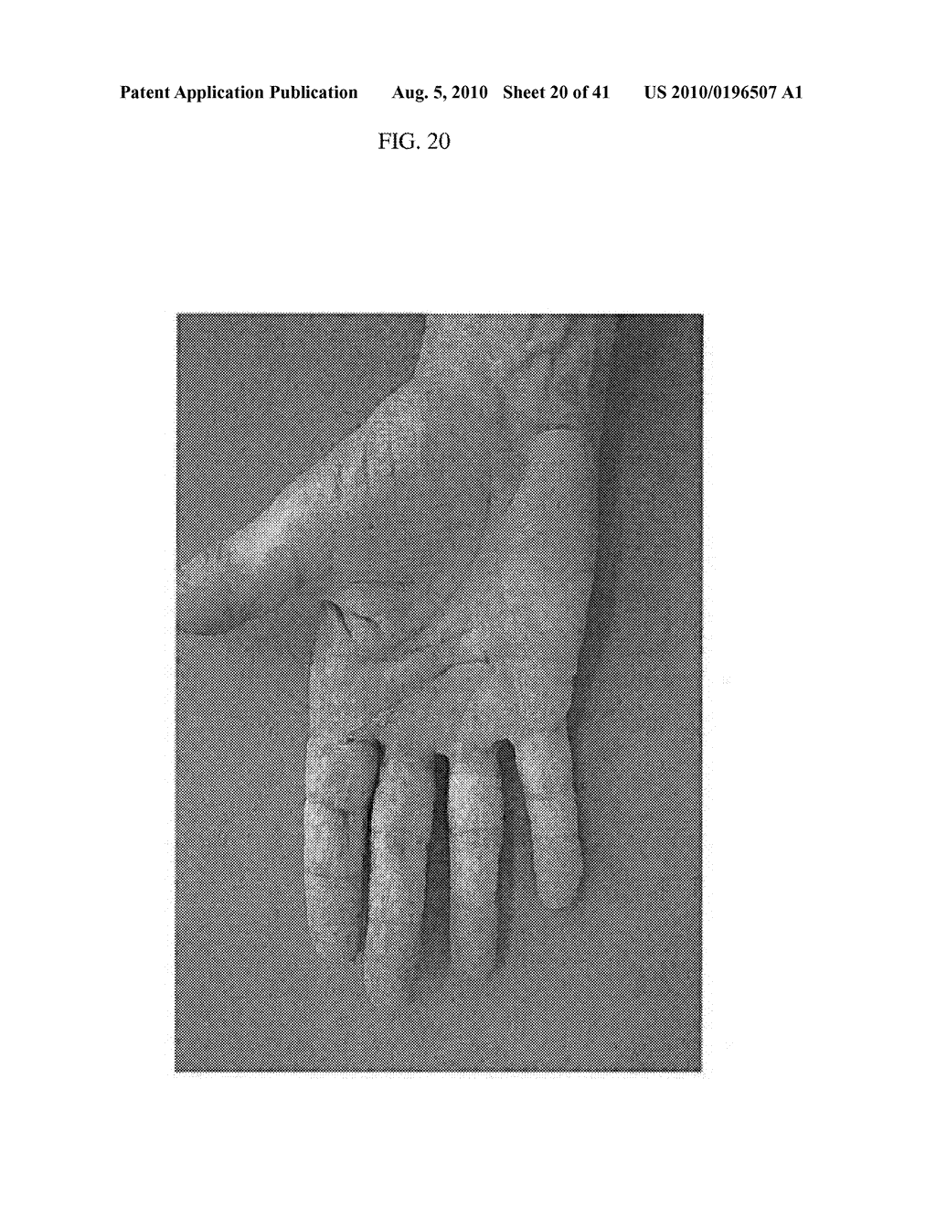 Treatment of Wounds and Compositions Employed - diagram, schematic, and image 21