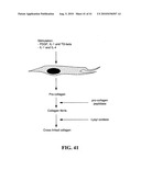 Treatment of Wounds and Compositions Employed diagram and image