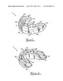 Orthodontic appliance diagram and image