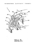 Orthodontic appliance diagram and image