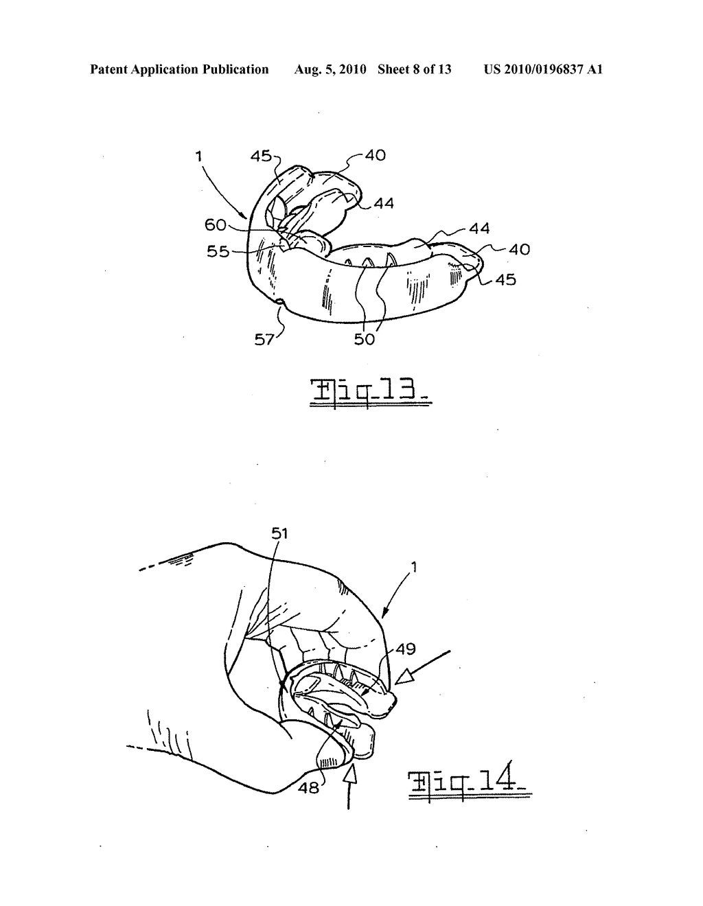 Orthodontic appliance - diagram, schematic, and image 09