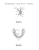 Orthodontic appliance diagram and image