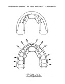 Orthodontic appliance diagram and image