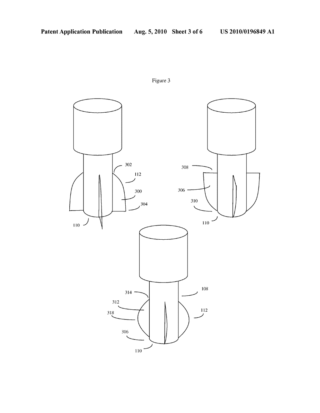 FLAPLESS DENTAL IMPLANT PUNCH - diagram, schematic, and image 04