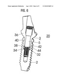 DENTAL IMPLANT AND METHOD FOR PROVIDING A MOUNTING PART diagram and image