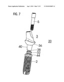 DENTAL IMPLANT AND METHOD FOR PROVIDING A MOUNTING PART diagram and image